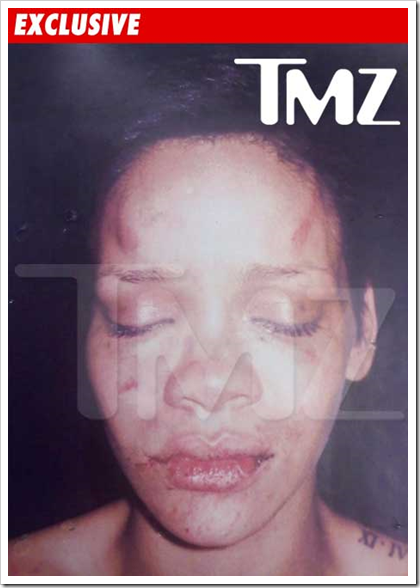 rihanna pictures beat up. Rihanna beat-down photo